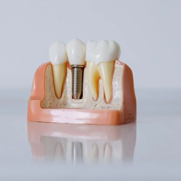 Implant Dentistry main