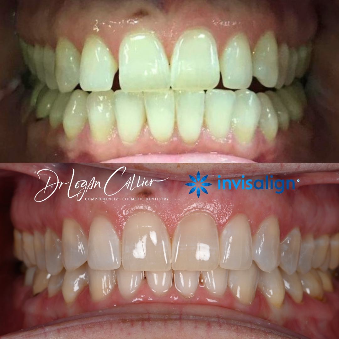 Our Gallery - Best Dentist in Garland, TX