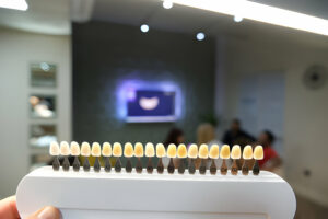 Porcelain Veneers in Garland, TX: What Cosmetic Issues Can Be Fixed_FI